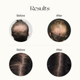 Nourish Mantra Advanced Hair Regrowth Serum 50ml | Book Bargain Buy
